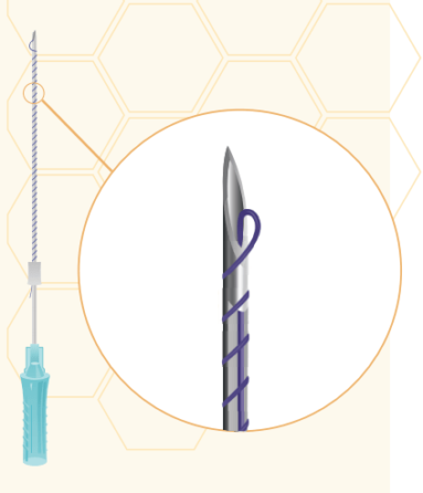 Нити рассасывающиеся Honey Derma Thread YRS 26-03 SCREW 26\60