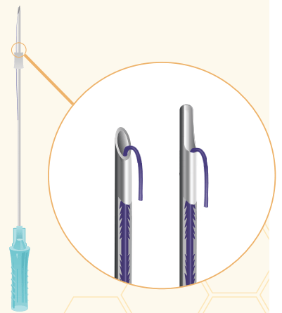 Нити рассасывающиеся Honey Derma Thread YRPN 19-84-L COG 2R 19 100-L