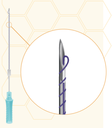 Нити рассасывающиеся Honey Derma Thread YRS 29-02 SCREW 29\38